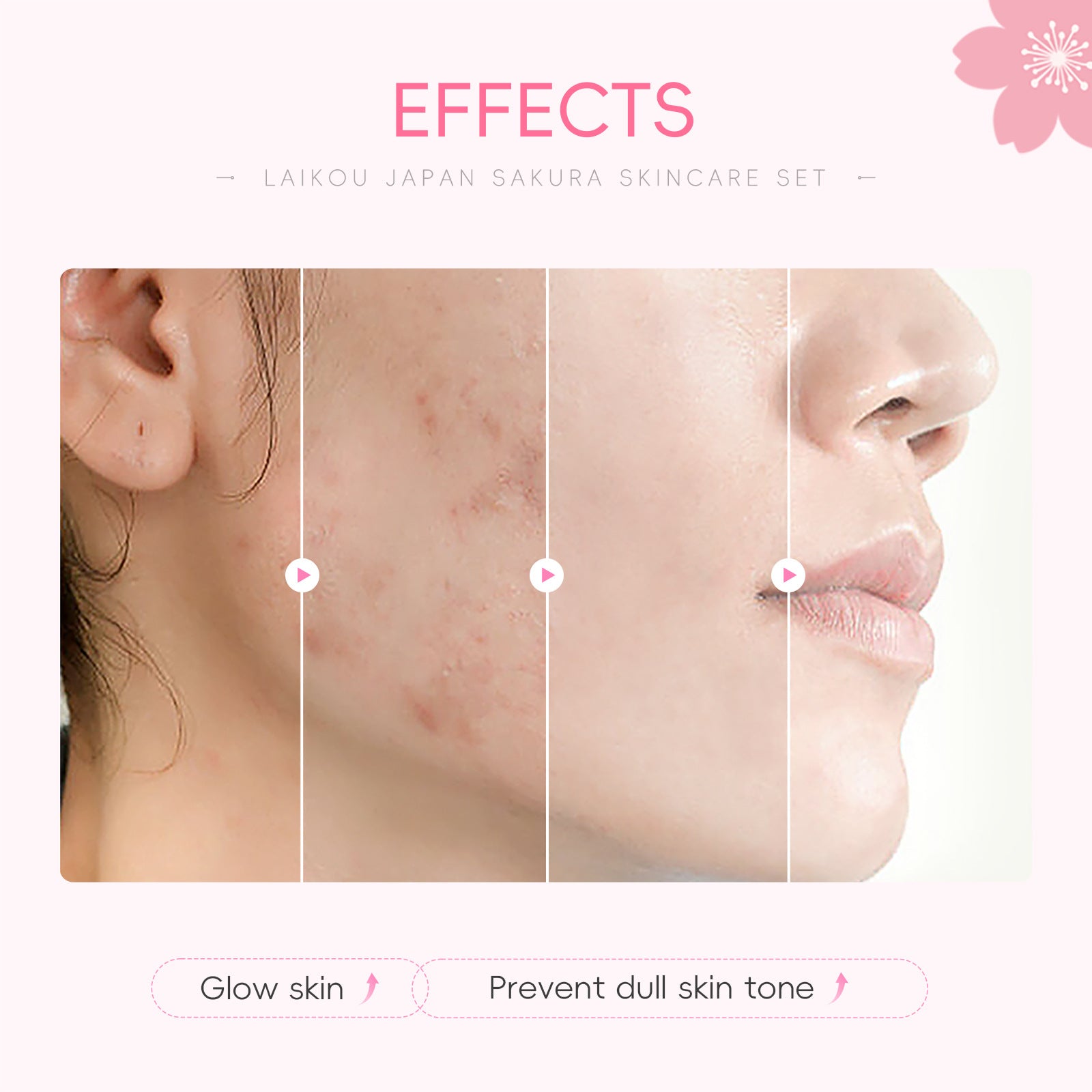 Conjunto de Cuidado Facial LAIKOU de 8 Piezas: Regalo de Cumpleaños con Productos de Belleza