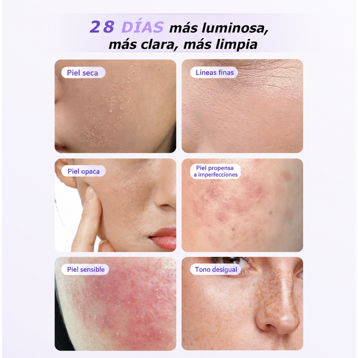 Mascarilla LED Facial Fotones 4 Luces Antienvejecimiento - 3